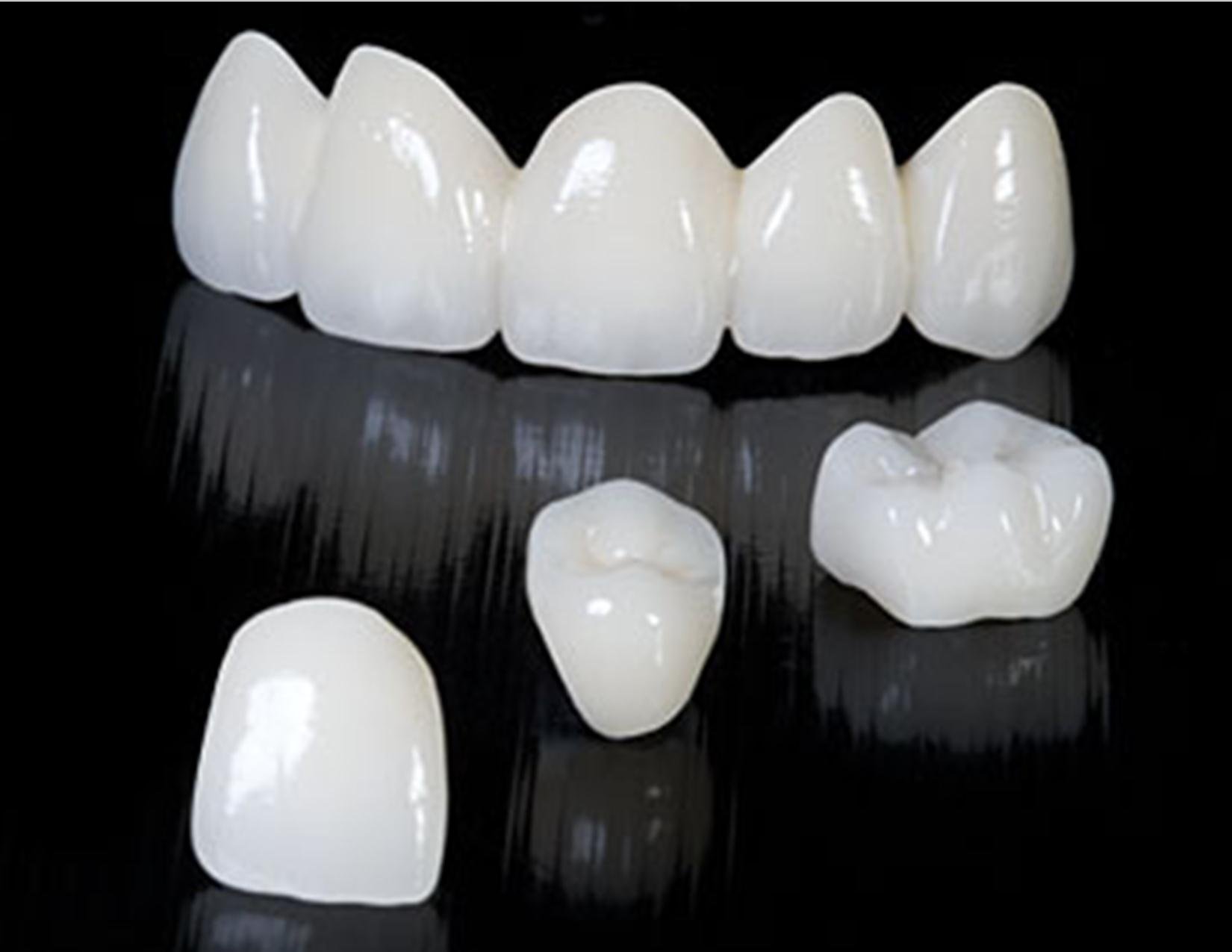 group Conversely ammunition Ce sunt coroanele dentare - Best Dental
