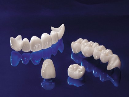 De ce sa optez pentru proteze dentare fixe din zirconiu?