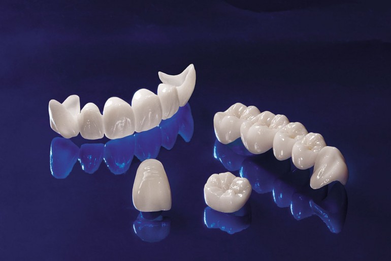 Challenge in the meantime Confront De ce sa optez pentru proteze dentare fixe din zirconiu? - Best Dental
